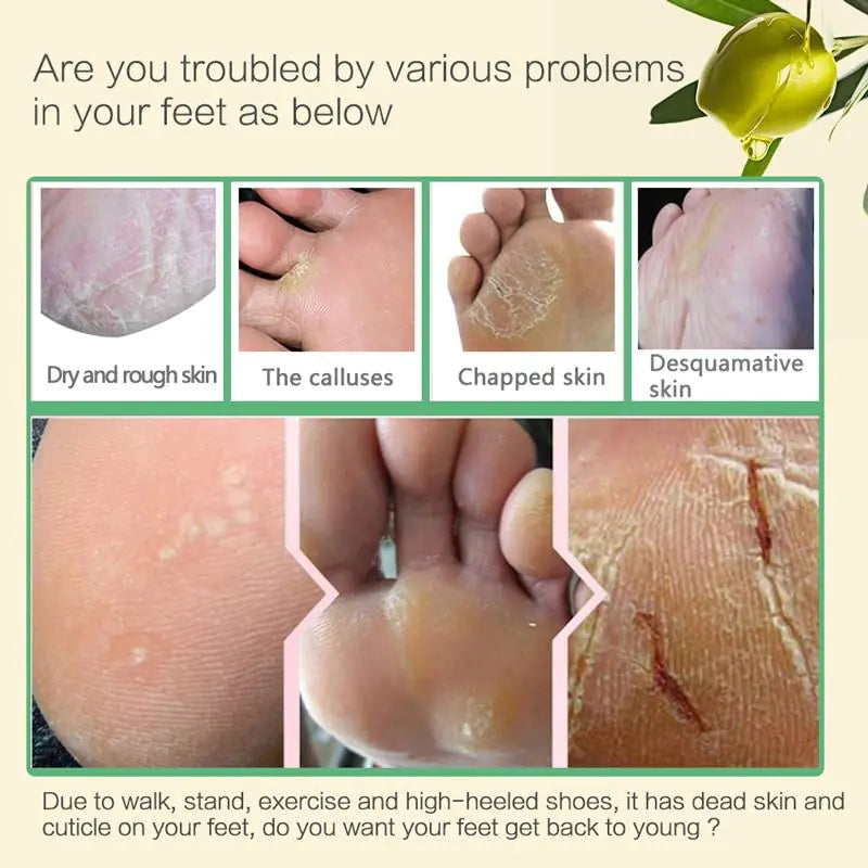 Masque Exfoliant pour les Pieds pour Peau Morte et Soin Hydratant