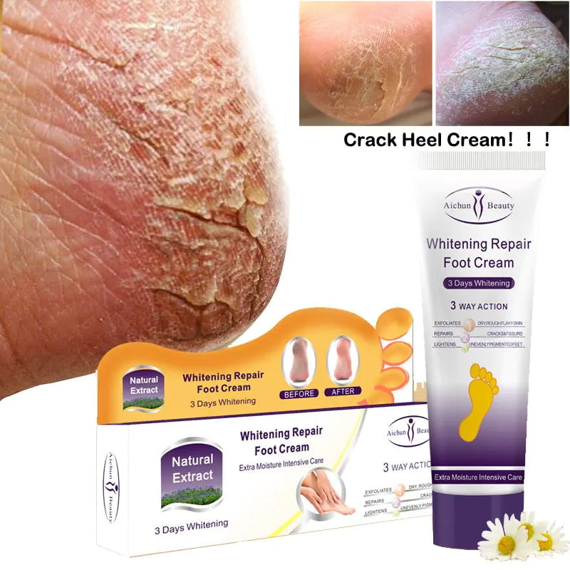 Crème de Réparation pour les Pieds Aichun, pour Pieds Secs et Fissurés